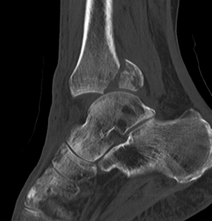 Foot and Ankle Conditions